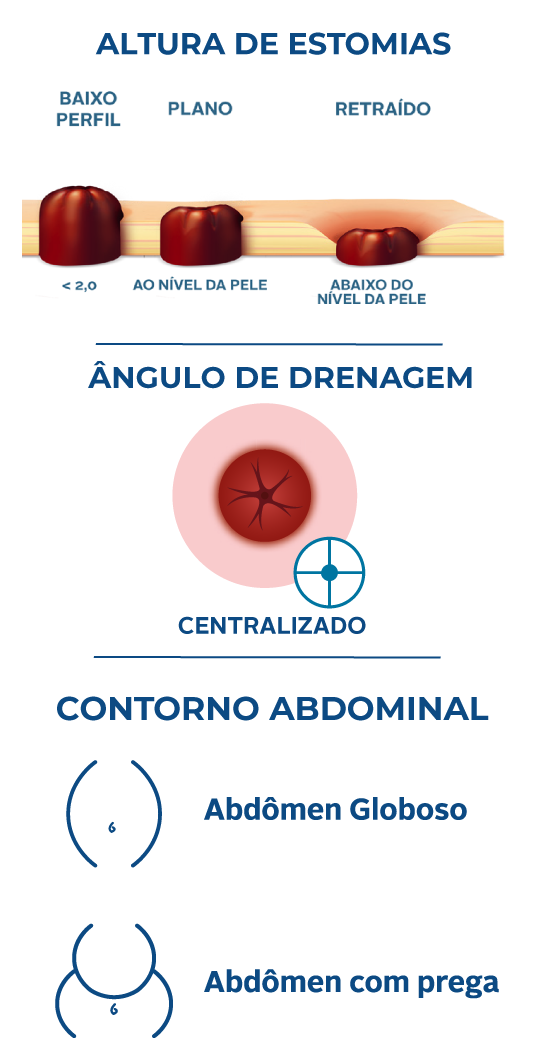 algoritmo-ostomy-convatec-o-que-e-equipamento-coletor-19