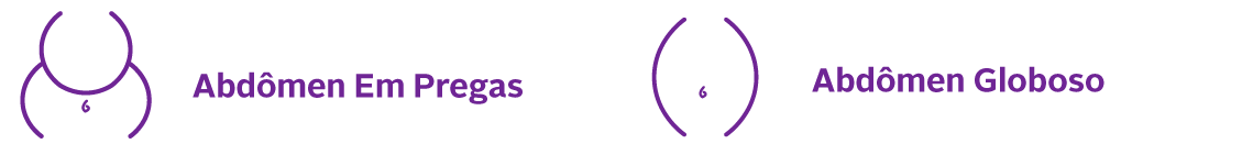 abdomen-globoso-em-pregas-horizontal