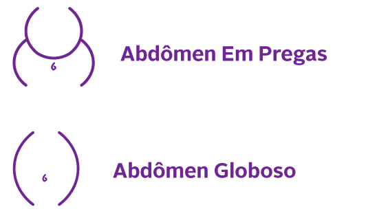 abdomen-globoso-em-pregas-vertical